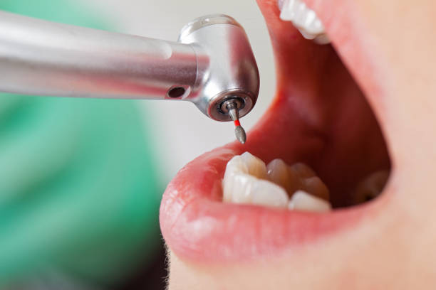 Best Root Canal Emergency Dentist  in Juno Beach, FL